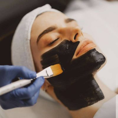 imagen de tratamiento hollywood peel en monterrey y san pedro